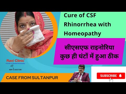 A case of CSF rhinorrhea from Sultanpur