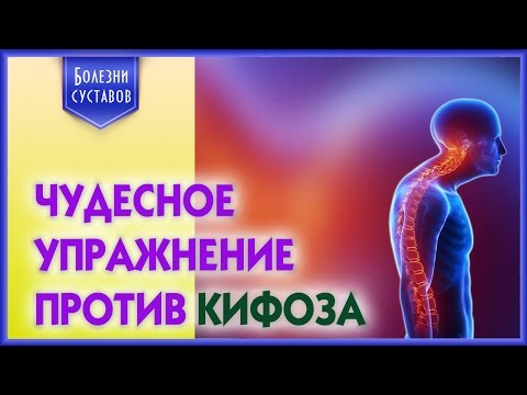 Лечится ли сколиоз 2 степени в 17 лет Для выпрямления осанки аптека