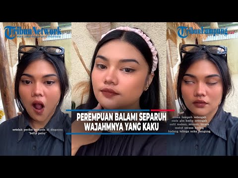 Viral Woman Shares Her Experience Having Half of Her Face Stiff