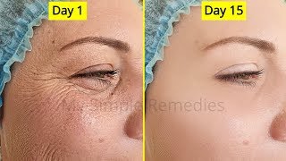 Japanese Secret To Look 10 Years Younger Than Your Age, Antiaging remedy, Remove Wrinkes &amp; Acne