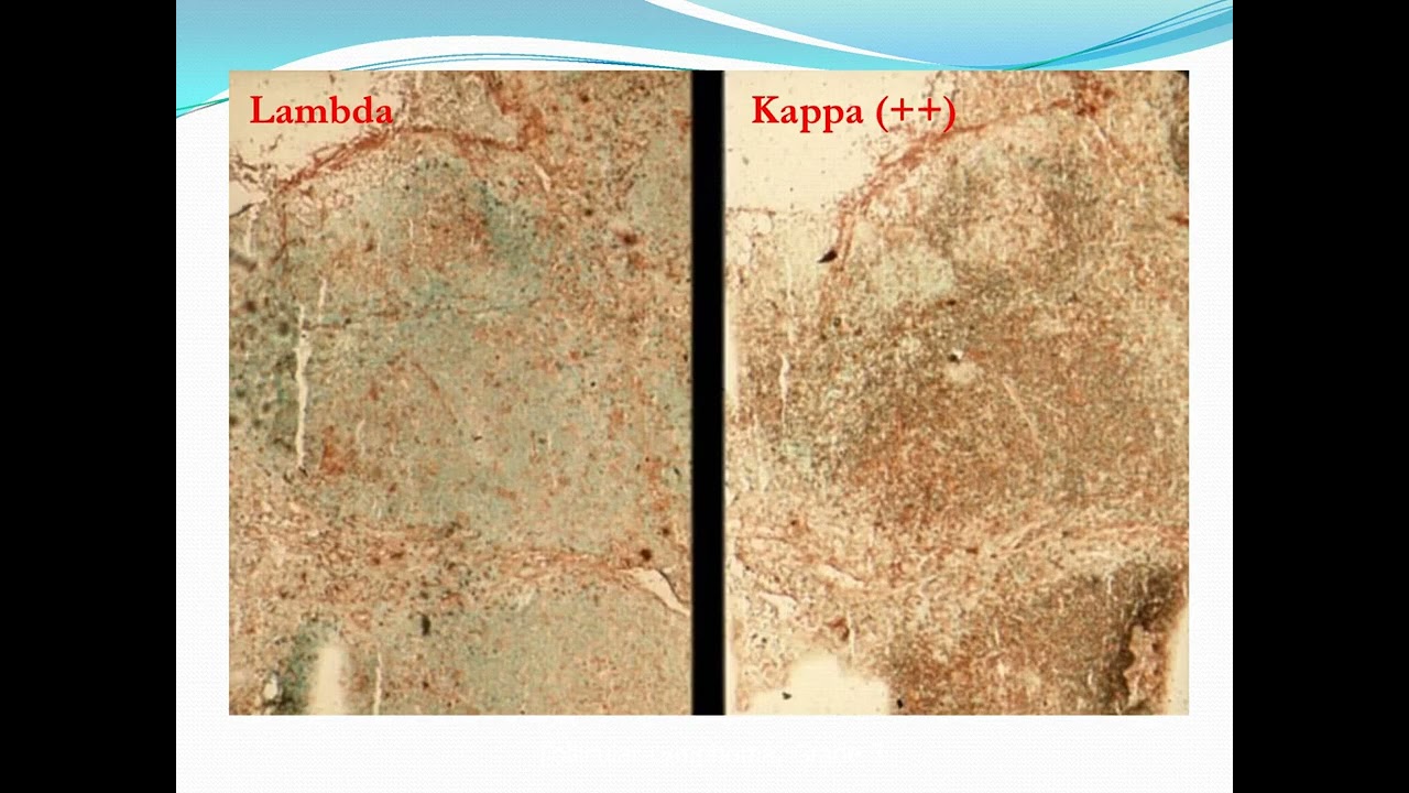 14 Introduction LymphNode Pathology
