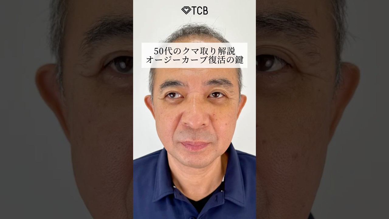 【クマ取り】50代のクマ取り解説、オージーカーブ復活の鍵#shorts