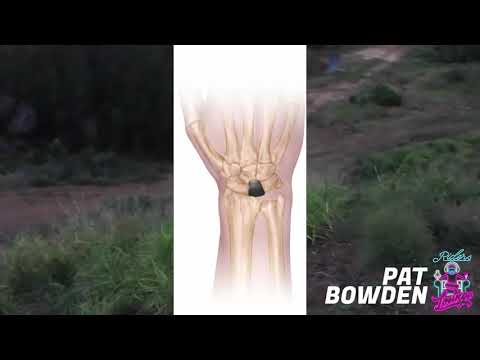 Pat Bowden cased this 220ft jump and his wrist collapsed!