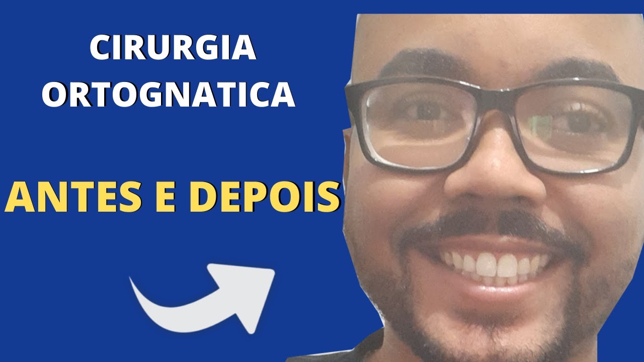 Bruno Nifossi Prado-39