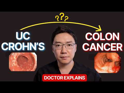 Can Ulcerative Colitis & Crohn's (IBD) Cause Colon CANCER (and Prevention)?