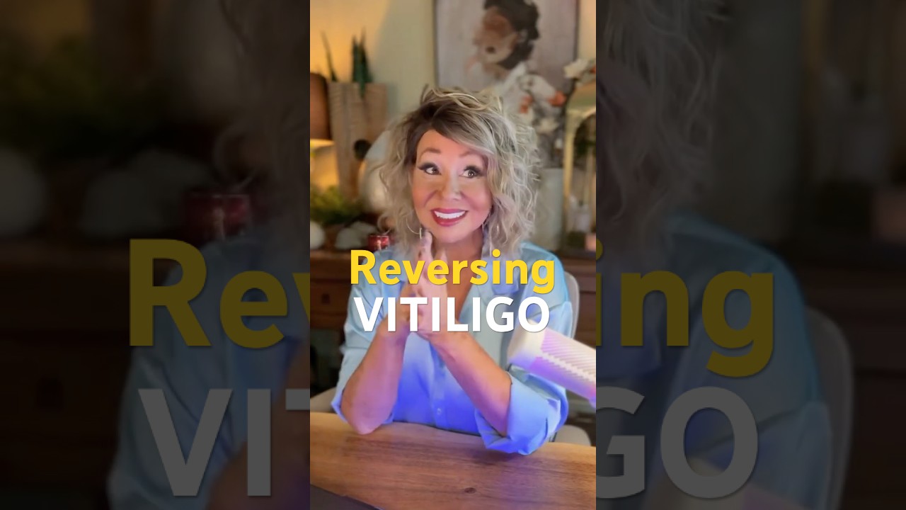 Could Vitiligo Be Reversible?