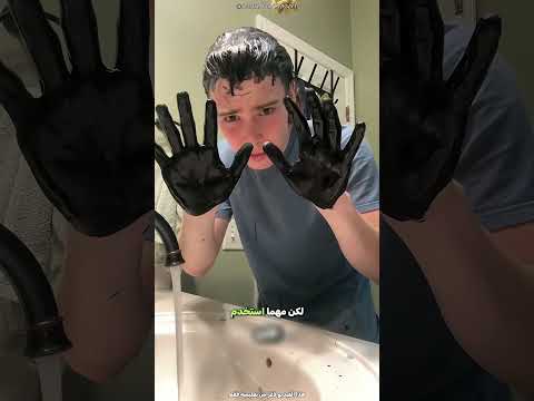 حاول الرجل صبغ شعره باللون الأسود 😮