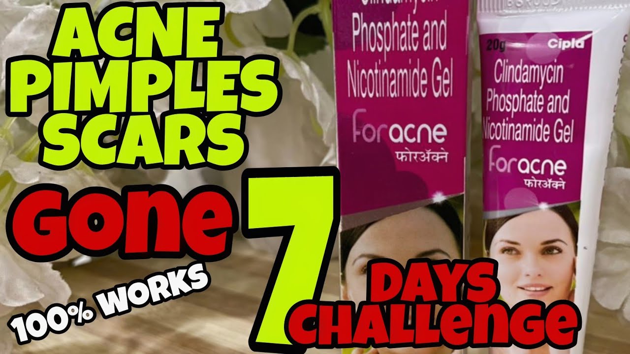 Watch video Clyndamicin & Nicotinamide Gel for Acne & Scars | Remove Acne/Pimples completely | Foracne By Cipla Now Clyndamicin & Nicotinamide Gel for Acne & Scars | Remove Acne/Pimples completely | Foracne By Cipla