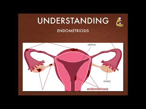 Endometriosis: Pain, Causes, Complications, and Treatment in Surat