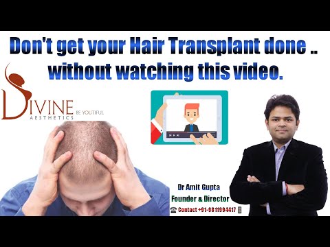 Hair Transplant