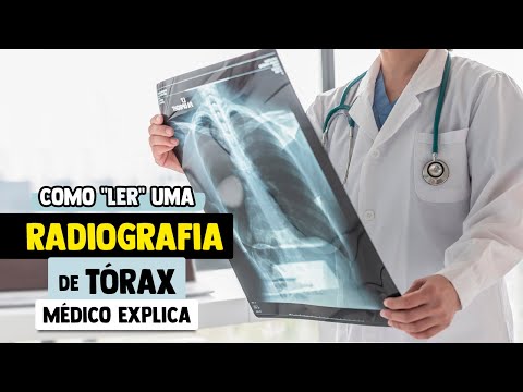 Como INTERPRETAR uma RADIOGRAFIA de Tórax │ Passo a Passo Explicado (ABCDE)