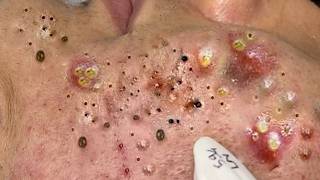 𝑺𝒐𝒐𝒕𝒉𝒊𝒏𝒈 𝑭𝒂𝒄𝒊𝒂𝒍 𝑻𝒓𝒆𝒂𝒕𝒎𝒆𝒏𝒕 𝑭𝒐𝒓 𝑺𝒕𝒓𝒆𝒔𝒔 𝑹𝒆𝒍𝒊𝒆𝒇 𝒂𝒕 𝑳𝒖𝒙𝒖𝒓𝒚 𝑺𝒑𝒂 𝑨𝒄𝒉𝒊𝒆𝒗𝒆 𝑰𝒏𝒏𝒆𝒓 𝑷𝒆𝒂𝒄𝒆 #887979