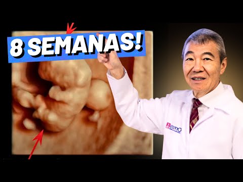 GRAVIDEZ 8 SEMANAS!