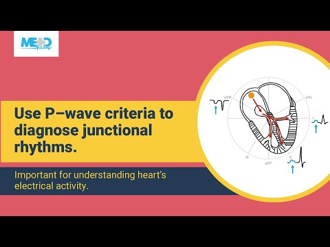 How to diagnose junctional rhythms