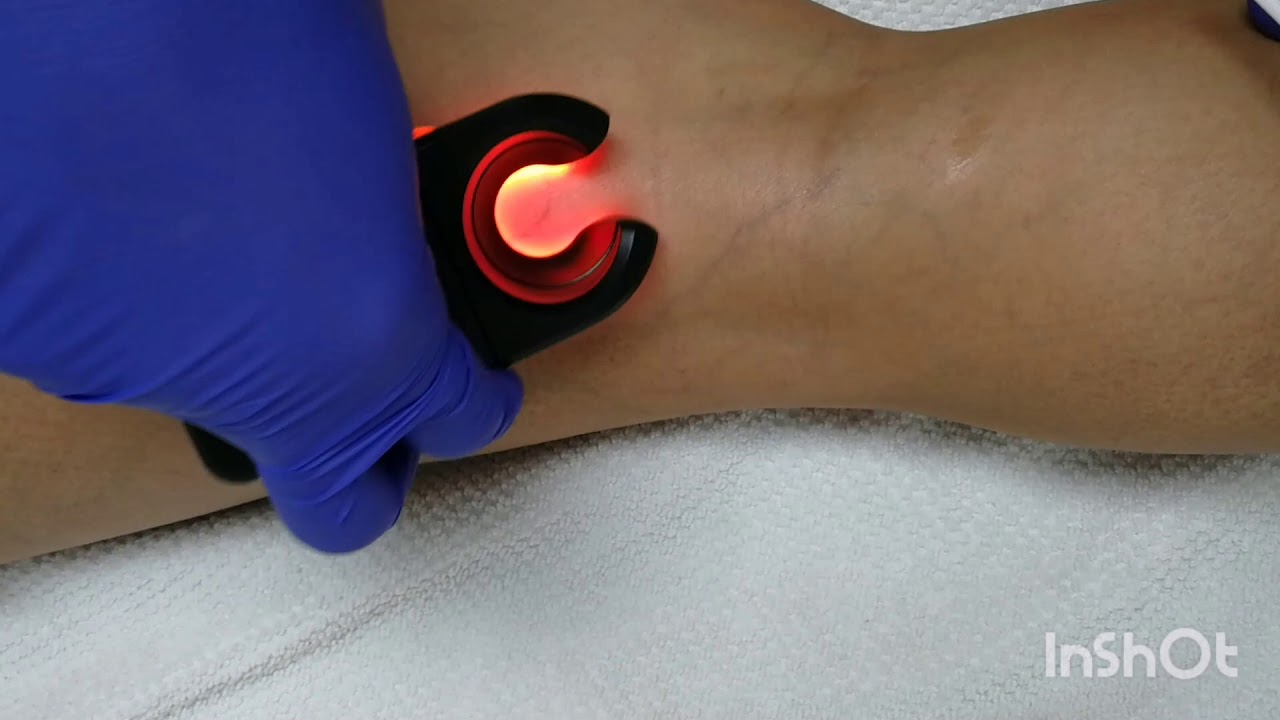 Ramiro Diego Abran-110