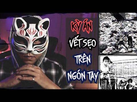 Kỳ Án | Vết Sẹo Trên Ngón Tay - Chuyện Vụ Án Đài Loan