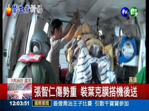 裝葉克膜搭機首例 張智仁送高醫