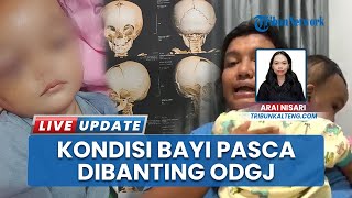 Kian Membaik, Bayi di Sampit yang Dibanting ODGJ Tak Perlu Operasi, tapi Alami Gangguan Pendengaran