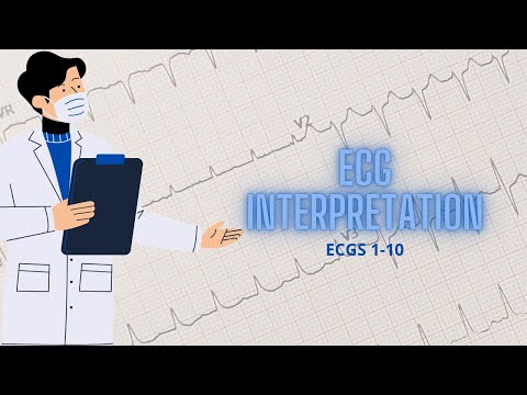 ECG Interpretation 1-10