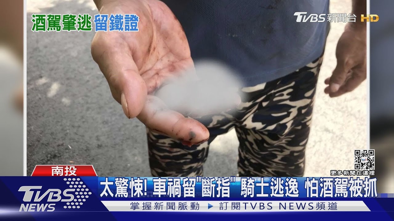 不能比中指了!騎士酒駕撞車斷指留現場 人落跑