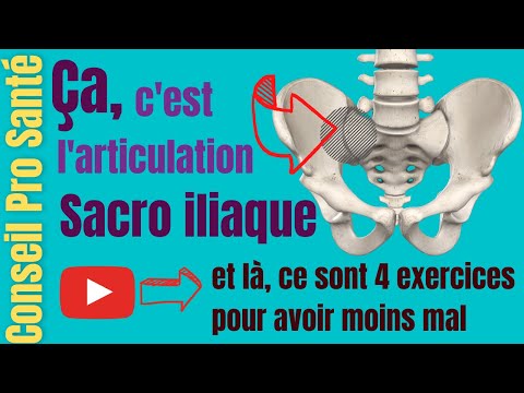 Exercices articulation Sacro iliaque : douleur, blocage, arthrose, comment soulager ?