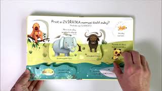 Kuk pod okénko - Proč si musím čistit zuby?