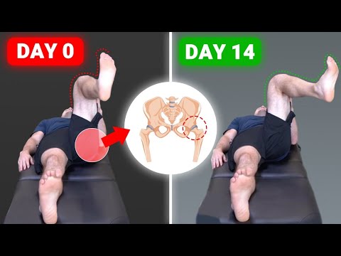 I Couldn't Improve My Hip Internal Rotation Until I Did This