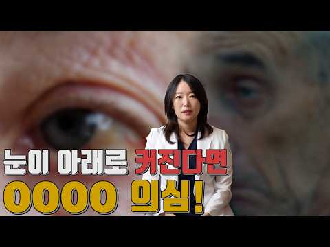 눈이 아래로 커진다면 의심해야 할 질환
