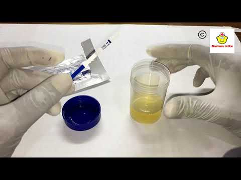 How to perform HCG Pregnancy test at home