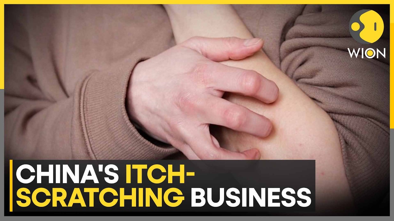 China's Itch-Scratching Business: Monthly Revenue Reaches 100,000 Yuan | WION News