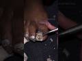 EXTREME TOENAIL TRANSFORMATION WHAT HAPPENED ACRYLIC FRENCH TIPS Toenails Nailtutorial