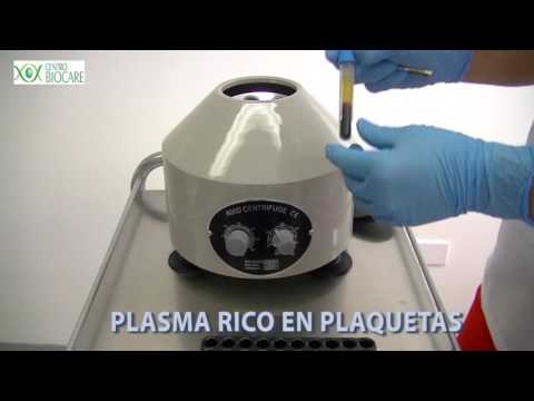 Cómo funciona una centrífuga para Plasma rico en plaquetas?
