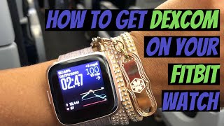 How to Get Dexcom on Your FitBit Watch
