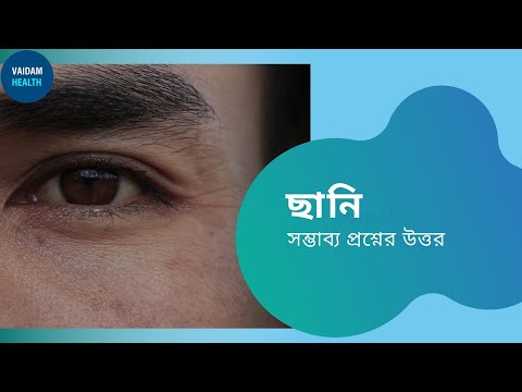 অস্পষ্ট দৃষ্টি - প্রায়শই জিজ্ঞাসিত প্রশ্ন (ছানি)