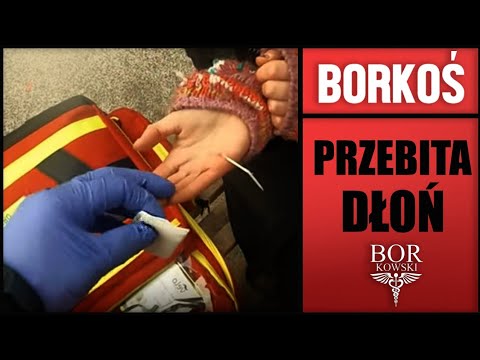 Motoambulans - ciało obce w dłoni