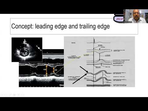 52nd Session 3 Part 2 of measurements with Q & A session by Dr Rakesh Gupta