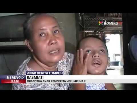 Watch lagu Images Videos Cerebral Palsy Dan Mikrosefali, Watch Images Cerebral Palsy Dan Mikrosefali free Watch, Watch Images Cerebral Palsy Dan Mikrosefali