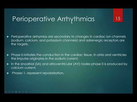 Perioperative arrhythmia