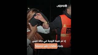 بسبب مزاولة مهنة الطب بدون ترخيص وتعريض صحة المواطنين للخطر.. عمليات تجميلية تورط 3 أشخاص بالمغرب thumbnail