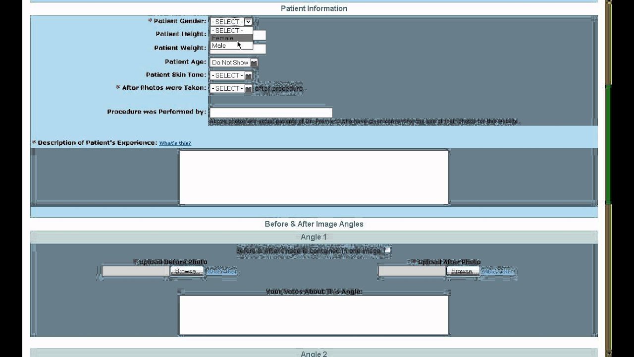 F   Before And After Gallery
