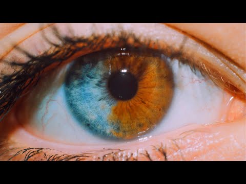 Nuevos Métodos Para Cambiar El Color De Ojos y Sus Complicaciones