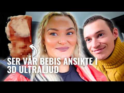 SER VÅR SONS ANSIKTE I 3D gravidvecka 27 (vår IVF-resa del 15)