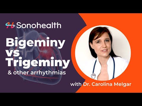 Bigeminy vs Trigeminy - PVCs & Arrhythmias