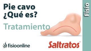 Pie cavo o arqueado - Qué es, causas, síntomas y tratamiento