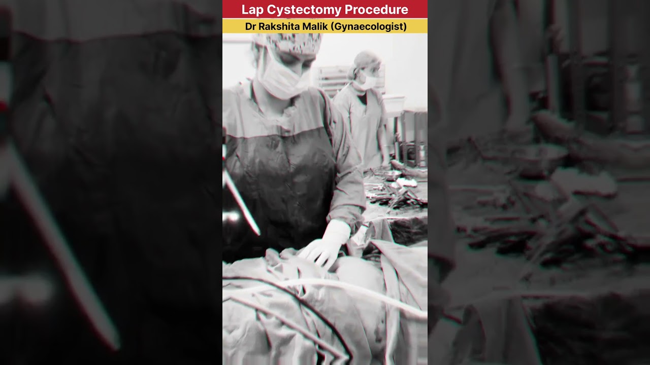 Laparoscopic Cystectomy Procedure by Dr Rakshita Malik #doctor #gynaecologist #ivfspecialist #mbbs