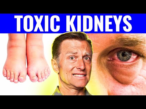 7 Warning Signs That Your Kidneys Are Toxic