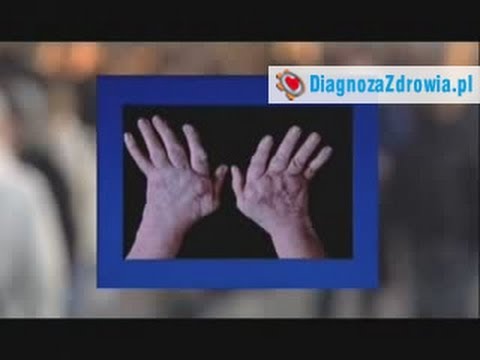 Impotencja leczenie w sanatoriach Preparaty na zwiększenie potencji skutków ubocznych