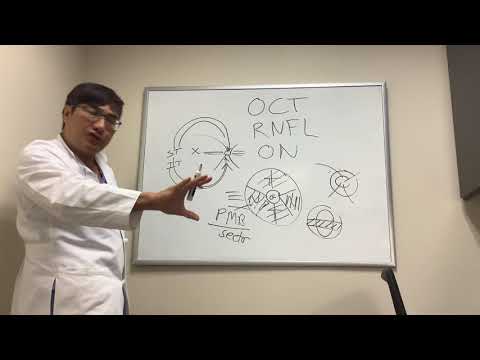 Understanding Optic Nerve OCT