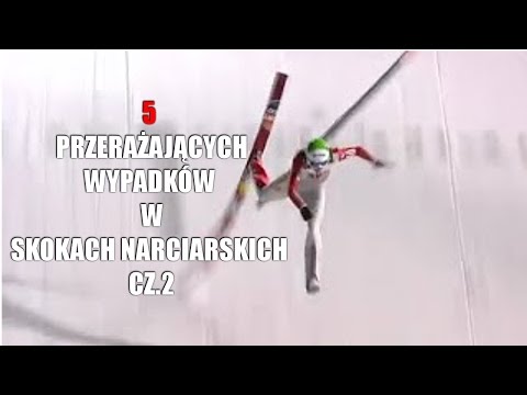Jak zrobić grube włosy straty Glis kurczaki przywrócenie włosów 6 efektów olej luksusu