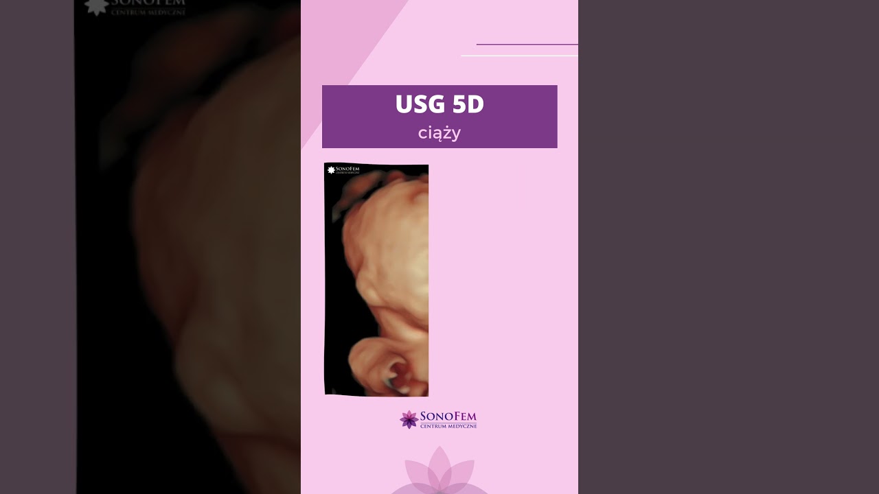 Anita Hamela-Olkowska-11